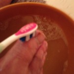 Ingrown Toenail Surgery & Post Op Care 13 Day1 Brushing 150x150 Ingrown Toenail Surgery & Post Op Care